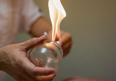 Cupping glass and flame